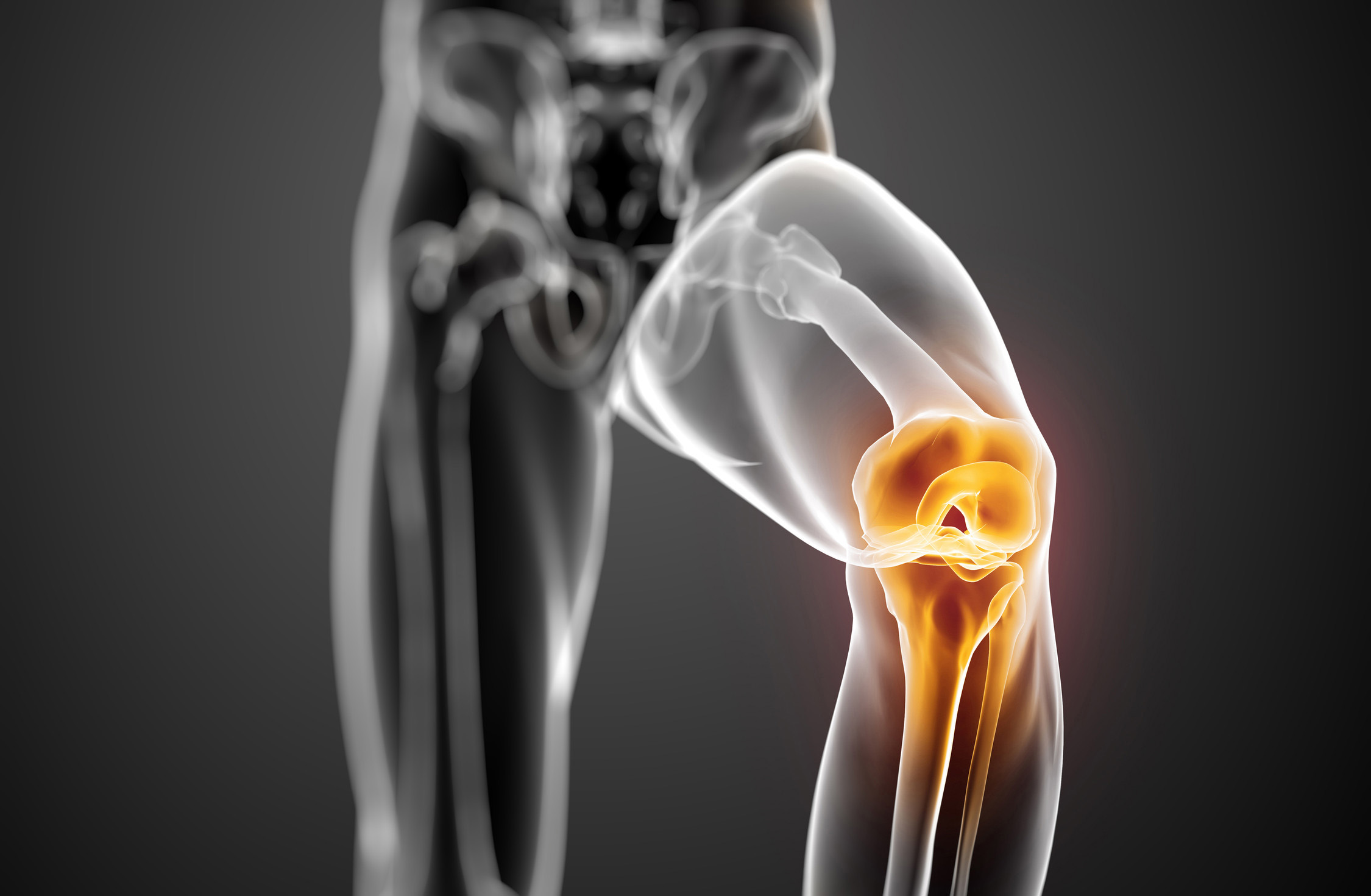 Curcumin Can Benefit Knee Joint Pain