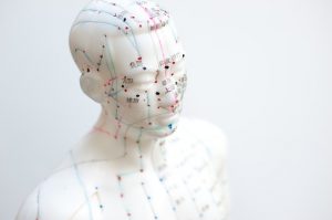 Acupuncture Provides Pain Relief More Powerful Than Opioids | www.naturallyhealthynews.com