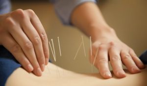Acupuncture Can Reduce Risk Of Gout and Kidney Damage 