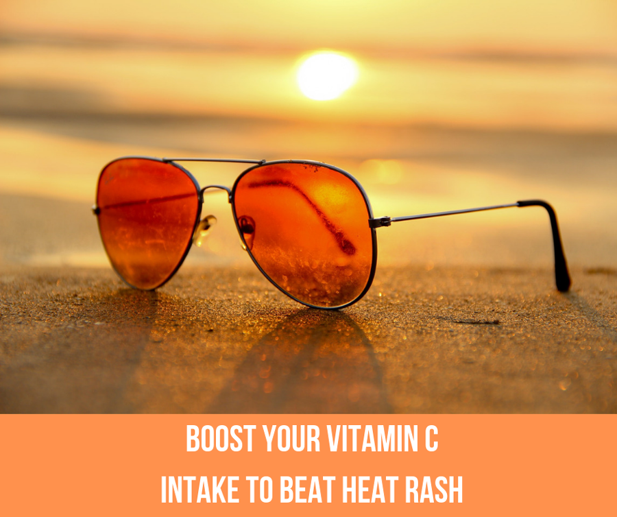 Boost Your Vitamin C Intake To Beat Heat Rash