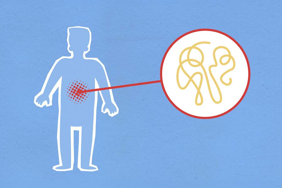 How Gut Health Influences Inflammation